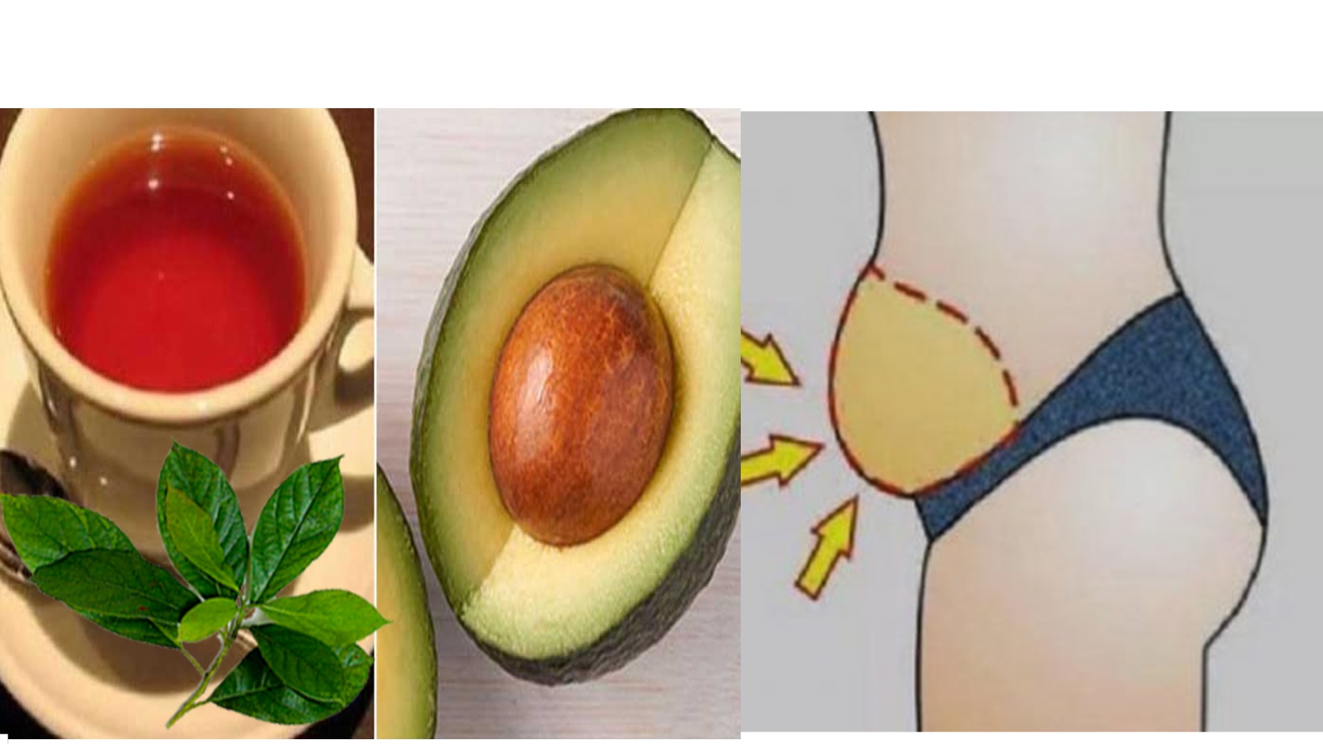 Hojas de aguacate Remedios consejos y SaludRemedios consejos y Salud